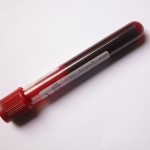 blood vial